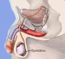 EPIDIDIMITIS�
