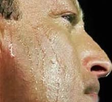 HIPERHIDROSIS�